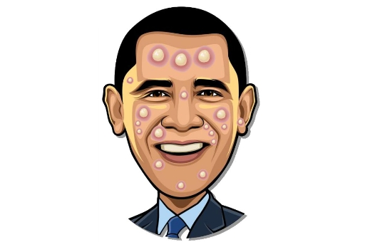Celebrity Pimple Pop